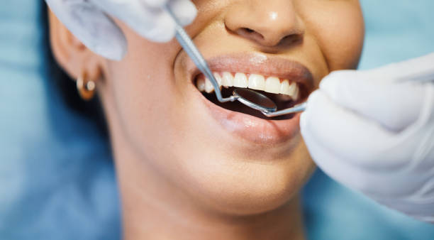 Best Urgent Care for Lost Fillings or Crowns in Holly Ridge, NC