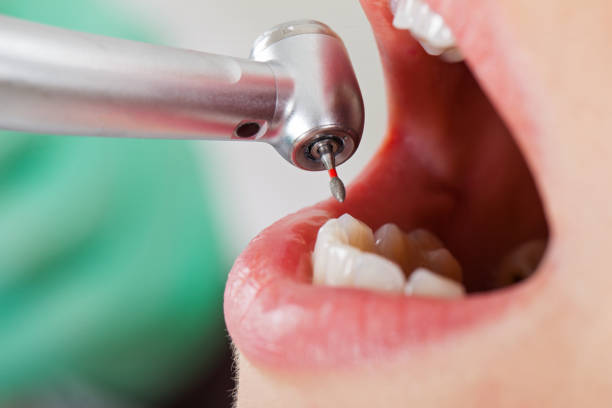 Best Emergency Dental Care for Broken or Chipped Teeth in Holly Ridge, NC